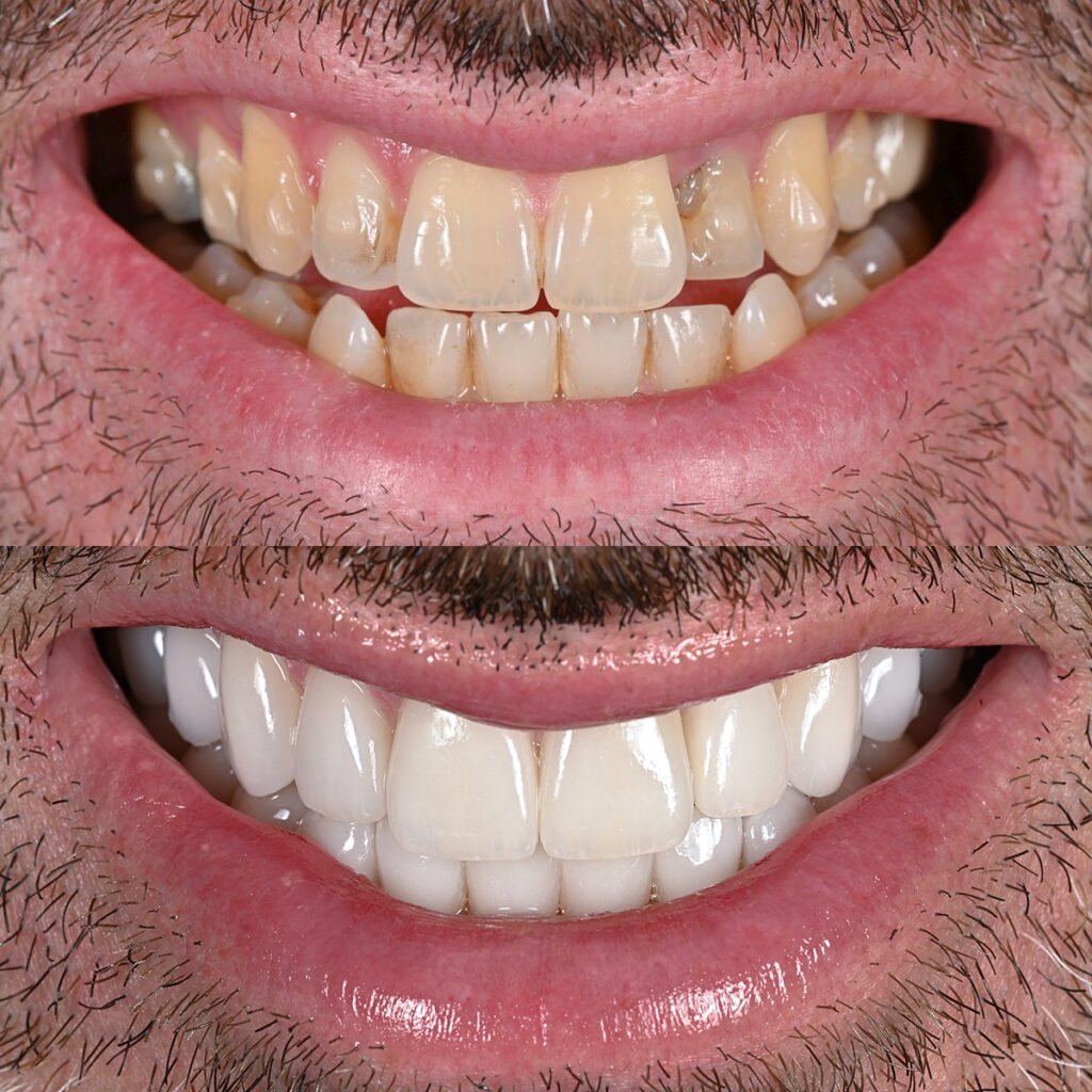Test B/A Treatment before treatment